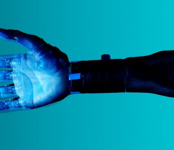 Un arto artificiale su uno sfondo azzurro